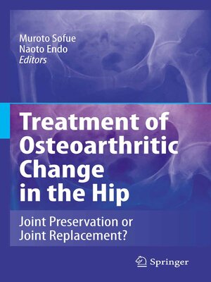 cover image of Treatment of Osteoarthritic Change in the Hip